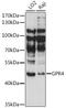 G Protein-Coupled Receptor 4 antibody, 16-370, ProSci, Western Blot image 