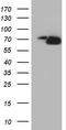 Phosphoinositide Kinase, FYVE-Type Zinc Finger Containing antibody, TA810375S, Origene, Western Blot image 