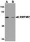 Leucine Rich Repeat Transmembrane Neuronal 2 antibody, orb75562, Biorbyt, Western Blot image 