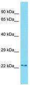 PYM1 antibody, TA342977, Origene, Western Blot image 