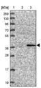 Calcium-binding and spermatid-specific protein 1 antibody, NBP1-91743, Novus Biologicals, Western Blot image 