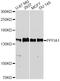 PTPRF Interacting Protein Alpha 1 antibody, A10388, ABclonal Technology, Western Blot image 
