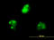 p68 antibody, LS-C133656, Lifespan Biosciences, Immunofluorescence image 