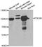PDE6B antibody, LS-C348994, Lifespan Biosciences, Western Blot image 