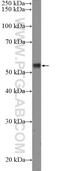 Ribosomal Protein S6 Kinase B2 antibody, 26194-1-AP, Proteintech Group, Western Blot image 