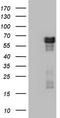 Receptor Interacting Serine/Threonine Kinase 3 antibody, TA803230S, Origene, Western Blot image 