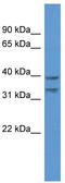 BRMS1 Like Transcriptional Repressor antibody, TA342943, Origene, Western Blot image 