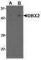 Developing Brain Homeobox 2 antibody, LS-B8830, Lifespan Biosciences, Western Blot image 