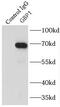Guanylate Binding Protein 1 antibody, FNab03373, FineTest, Immunoprecipitation image 