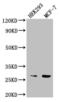 Nudix Hydrolase 21 antibody, LS-B15156, Lifespan Biosciences, Western Blot image 