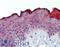 Akirin 2 antibody, LS-B3831, Lifespan Biosciences, Immunohistochemistry paraffin image 