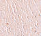Leucine Rich Repeat Transmembrane Neuronal 3 antibody, A11290, Boster Biological Technology, Immunohistochemistry frozen image 