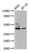 UDP-GlcNAc:BetaGal Beta-1,3-N-Acetylglucosaminyltransferase 6 antibody, CSB-PA744392LA01HU, Cusabio, Western Blot image 