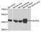 Acyl-CoA Dehydrogenase Long Chain antibody, A1266, ABclonal Technology, Western Blot image 
