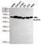 Aldehyde Dehydrogenase 2 Family Member antibody, TA346880, Origene, Western Blot image 