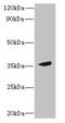 Metallophosphoesterase Domain Containing 2 antibody, orb355647, Biorbyt, Western Blot image 