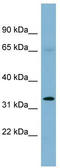 Hes Related Family BHLH Transcription Factor With YRPW Motif 1 antibody, TA346068, Origene, Western Blot image 