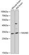N(Alpha)-Acetyltransferase 60, NatF Catalytic Subunit antibody, 22-906, ProSci, Western Blot image 