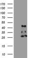 NADH:Ubiquinone Oxidoreductase Subunit B11 antibody, TA807693S, Origene, Western Blot image 