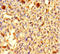 C2 Calcium Dependent Domain Containing 6 antibody, LS-C395648, Lifespan Biosciences, Immunohistochemistry paraffin image 