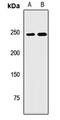 Neuroblastoma Amplified Sequence antibody, LS-C668321, Lifespan Biosciences, Western Blot image 