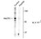 Methyl-CpG Binding Protein 2 antibody, PA5-35396, Invitrogen Antibodies, Western Blot image 