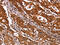 e3B1 antibody, CSB-PA961270, Cusabio, Immunohistochemistry paraffin image 
