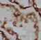 Acyl-CoA Dehydrogenase Medium Chain antibody, FNab00065, FineTest, Immunohistochemistry paraffin image 