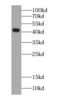Cystathionine Gamma-Lyase antibody, FNab03336, FineTest, Western Blot image 