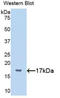 PLAG1 Like Zinc Finger 1 antibody, LS-C295975, Lifespan Biosciences, Western Blot image 