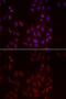 Secreted frizzled-related protein 3 antibody, GTX32611, GeneTex, Immunofluorescence image 