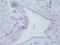 Prefoldin Subunit 5 antibody, A51513-100, Epigentek, Immunohistochemistry paraffin image 