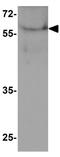 Palmdelphin antibody, GTX32160, GeneTex, Western Blot image 