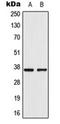 Aldo-Keto Reductase Family 1 Member E2 antibody, orb224132, Biorbyt, Western Blot image 