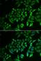 Inositol Polyphosphate-5-Phosphatase J antibody, LS-C335692, Lifespan Biosciences, Immunofluorescence image 