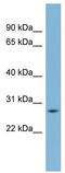 Guanidinoacetate N-Methyltransferase antibody, TA329508, Origene, Western Blot image 