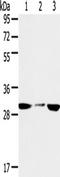 Succinate Dehydrogenase Complex Iron Sulfur Subunit B antibody, TA351639, Origene, Western Blot image 