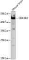 Cyclin-dependent kinase 5 activator 2 antibody, 16-993, ProSci, Western Blot image 