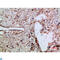 C-X-C Motif Chemokine Ligand 5 antibody, LS-C813843, Lifespan Biosciences, Immunohistochemistry paraffin image 