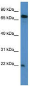 SFT2 Domain Containing 3 antibody, TA343014, Origene, Western Blot image 
