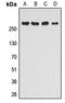 Mechanistic Target Of Rapamycin Kinase antibody, LS-C368624, Lifespan Biosciences, Western Blot image 