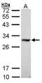Dimethylarginine Dimethylaminohydrolase 1 antibody, orb74241, Biorbyt, Western Blot image 
