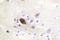 Alpha-PAK antibody, LS-C176625, Lifespan Biosciences, Immunohistochemistry frozen image 