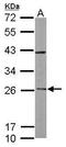 RAB3C, Member RAS Oncogene Family antibody, TA308098, Origene, Western Blot image 
