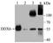 Probable ATP-dependent RNA helicase DDX6 antibody, A03826, Boster Biological Technology, Western Blot image 