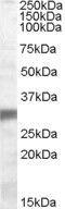 Egl nine homolog 3 antibody, GTX88678, GeneTex, Western Blot image 