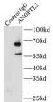 Angiopoietin Like 2 antibody, FNab00397, FineTest, Immunoprecipitation image 