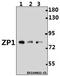 Zona Pellucida Glycoprotein 1 antibody, A06897, Boster Biological Technology, Western Blot image 