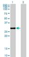 Capping Actin Protein Of Muscle Z-Line Subunit Beta antibody, H00000832-M03, Novus Biologicals, Western Blot image 