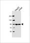 PPFIA Binding Protein 1 antibody, LS-B13770, Lifespan Biosciences, Western Blot image 